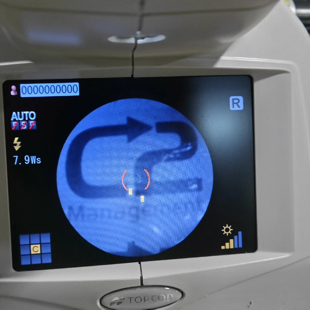 Topcon TRC-NW8F Multi-Functional Non-Mydriatic Retinal Camera